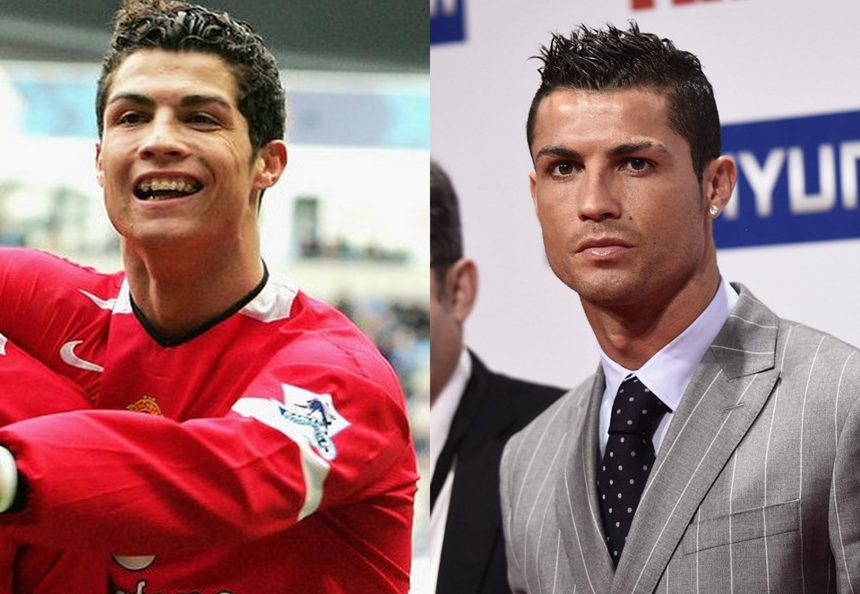 Ronaldo estetiğe servet harcadı